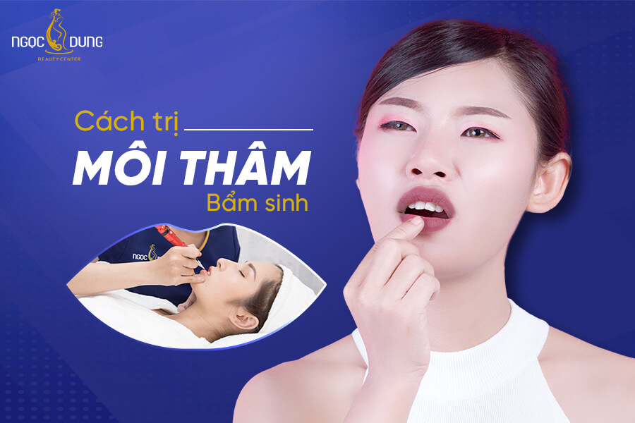 10 Cách trị môi thâm bẩm sinh nhanh, hiệu quả, ít tốn công