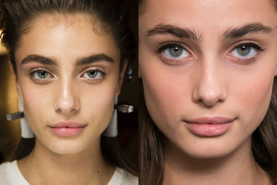 Triệt lông mày giao nhau bằng công nghệ laser hiện đại Triệt lông mày giao nhau bằng công nghệ laser hiện đại