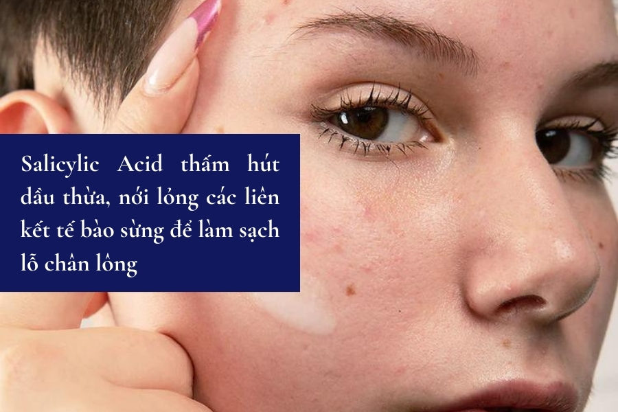 Cơ chế hoạt động của Salicylic Acid là gì? Cơ chế hoạt động của Salicylic Acid là gì?