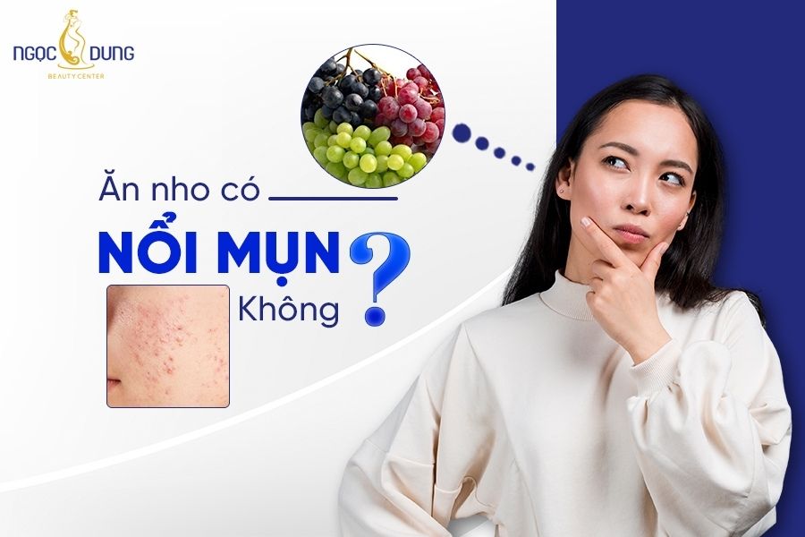Ăn nho có nổi mụn không? Giải đáp ngay vấn đề này cùng chuyên gia