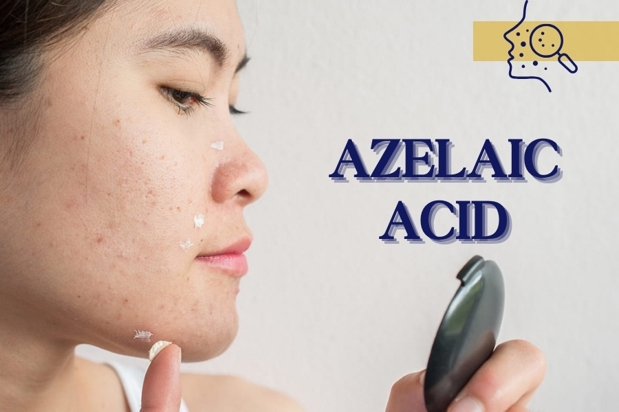 Acid Azelaic là gì? Azelaic Acid là axit dicarboxylic tự nhiên, có nguồn gốc từ các loại ngũ cốc Acid Azelaic là gì? Azelaic Acid là axit dicarboxylic tự nhiên, có nguồn gốc từ các loại ngũ cốc