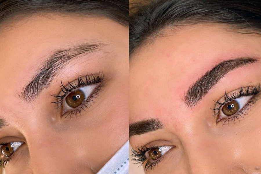 Bị ngứa, sưng và nhiễm trùng là một trong những hậu quả điêu khắc lông mày hay gặp nhất Bị ngứa, sưng và nhiễm trùng là một trong những hậu quả điêu khắc lông mày hay gặp nhất