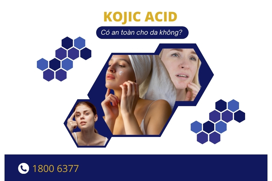 Kojic Acid có an toàn cho da? Kojic Acid có an toàn cho da?