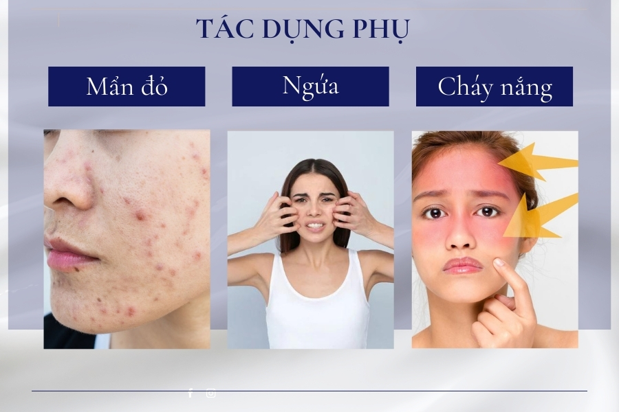 Glycolic Acid dễ làm da bị kích ứng hơn Lactic Acid hay Citric Acid do có cấu trúc phân tử nhỏ