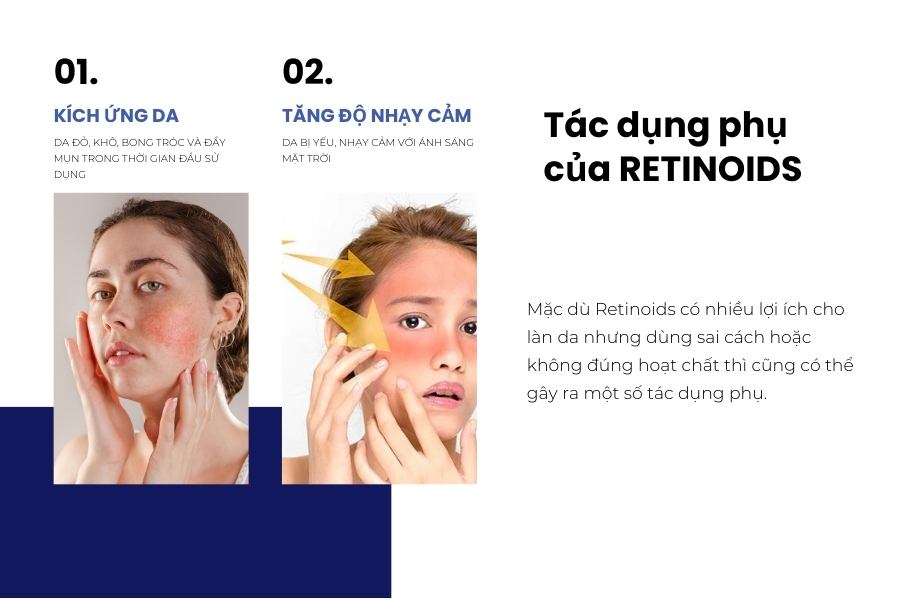 Những tác dụng phụ của Retinoid là gì? Những tác dụng phụ của Retinoid là gì?