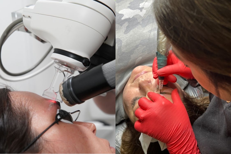 Quy trình sửa lỗi chân mày phun xăm hỏng