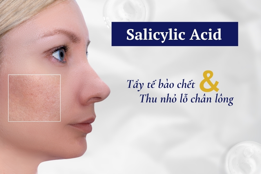 Salicylic Acid có tác dụng tẩy tế bào chết, thu nhỏ lỗ chân lông Salicylic Acid có tác dụng tẩy tế bào chết, thu nhỏ lỗ chân lông