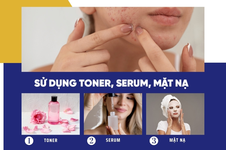 Toner và mặt nạ dưỡng da đóng vai trò vô cùng quan trọng trong quá trình phục hồi da sau nặn mụn