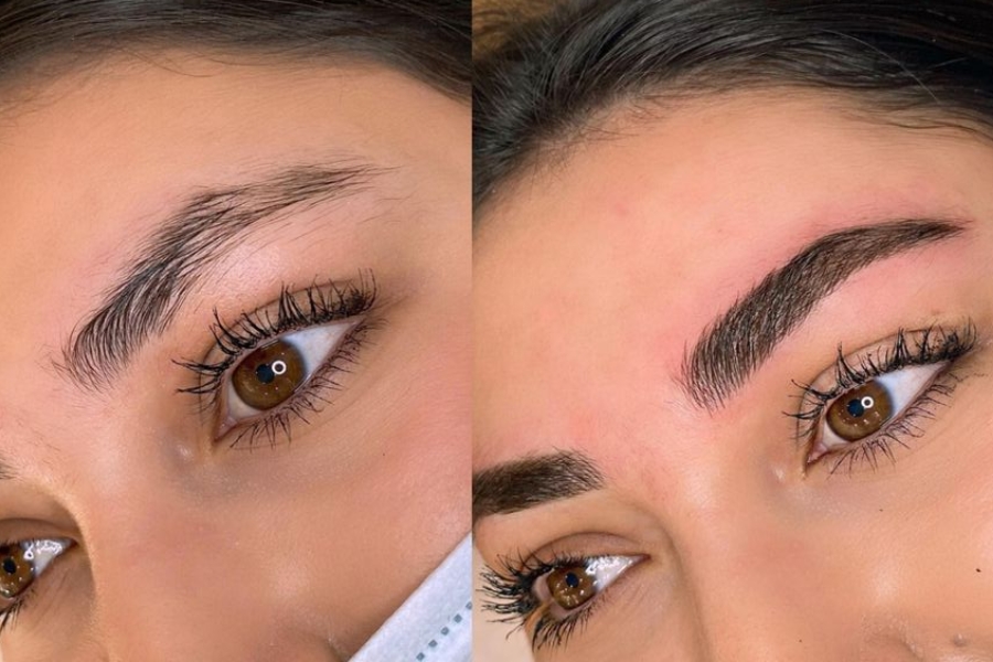 Bị sưng sau khi phun chân mày là phản ứng tự nhiên của da khi bị tác động bằng kim phun xăm Bị sưng sau khi phun chân mày là phản ứng tự nhiên của da khi bị tác động bằng kim phun xăm