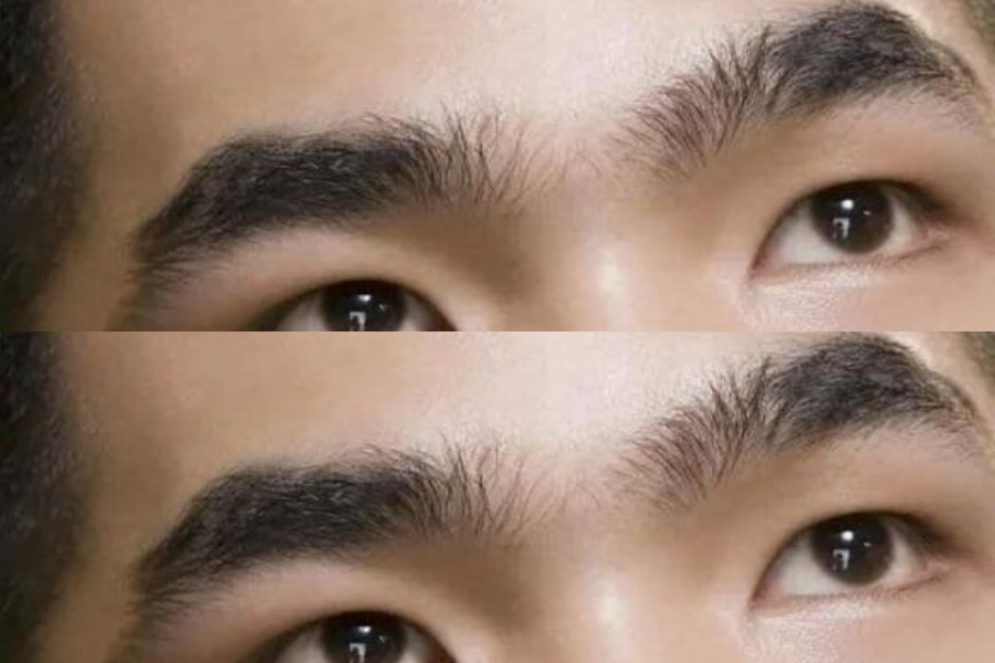 Tướng lông mày che khuất ấn đường - Đường tài lộc suy yếu