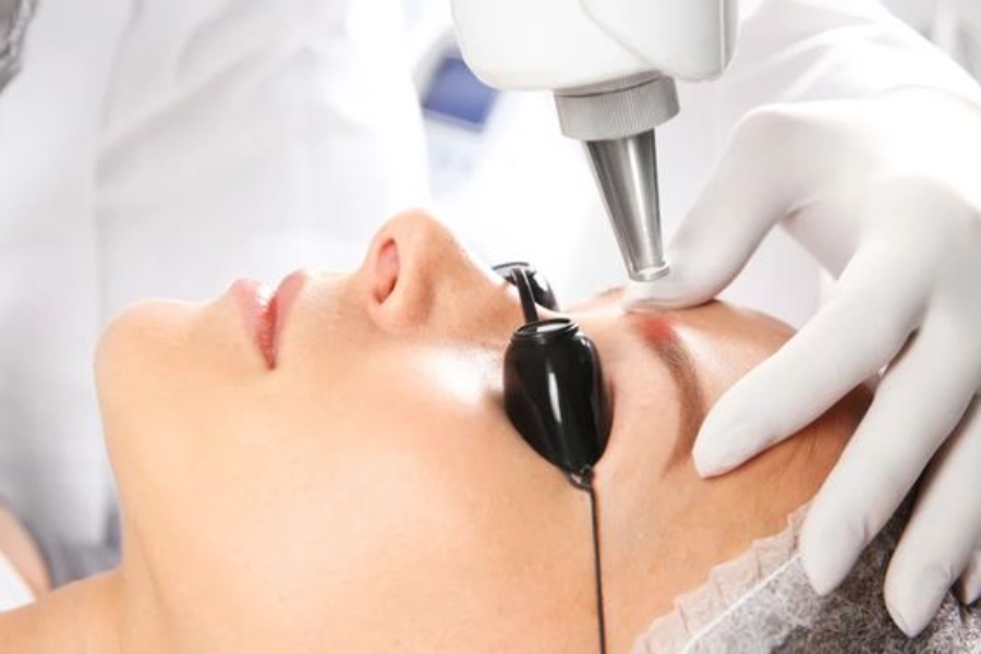 Xóa xăm chân mày lỗi công nghệ laser thế hệ mới Picosure Pro