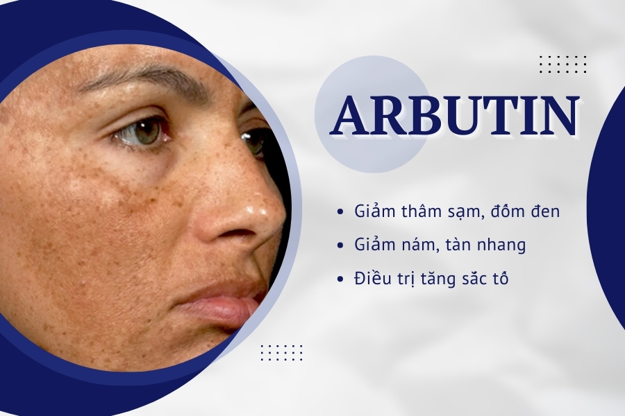 Công dụng chăm sóc da của Alpha Arbutin là gì?