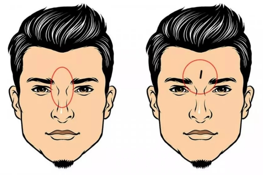 Ấn đường rộng cho thấy tài chính dồi dào, sự nghiệp gặp nhiều may mắn Ấn đường rộng cho thấy tài chính dồi dào, sự nghiệp gặp nhiều may mắn