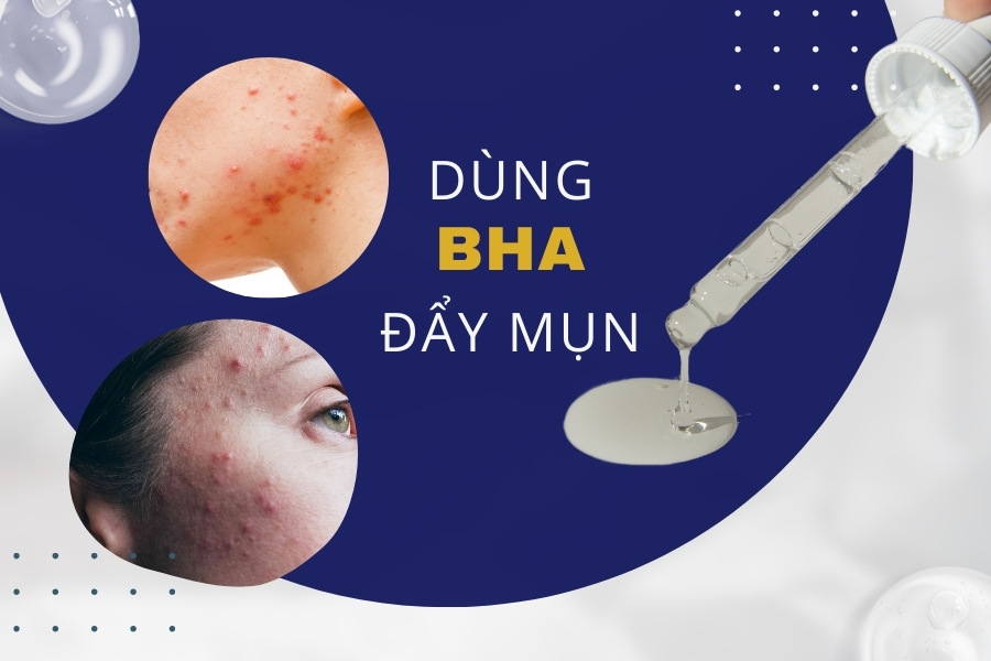 Dùng BHA đẩy mụn ẩn có được không?