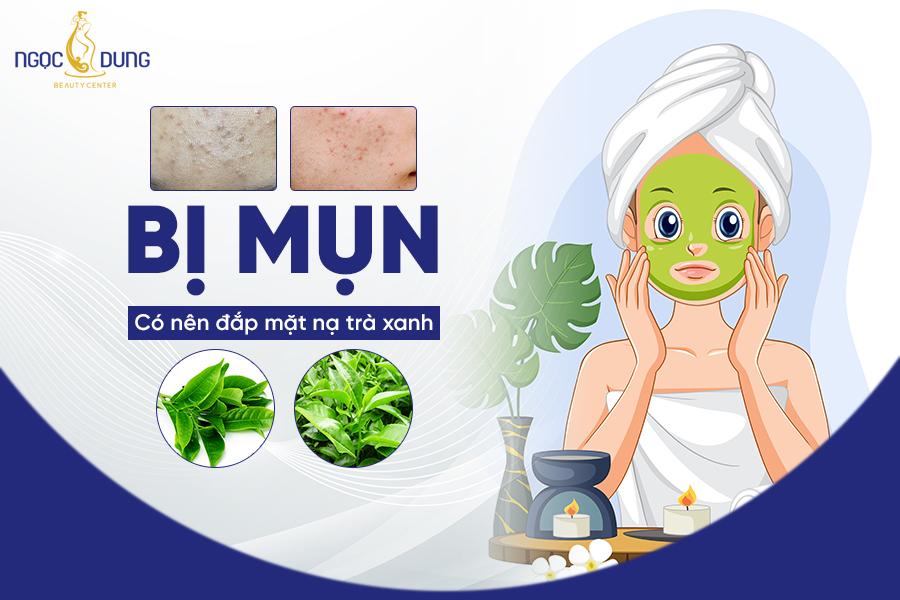 Bị mụn có nên đắp mặt nạ trà xanh không