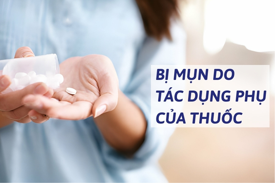 Một số tác dụng phụ của thuốc có thể gây mụn