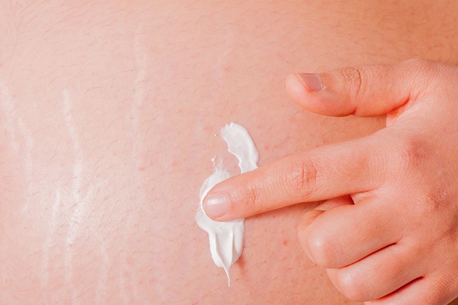 Dùng thuốc bôi theo đơn kê của bác sĩ để điều trị viêm lỗ chân lông ở vùng kín