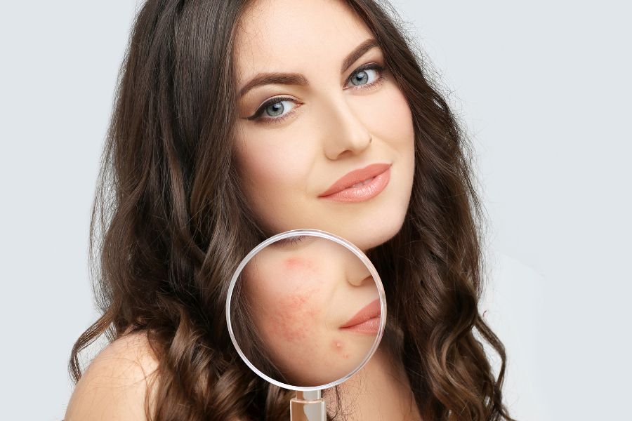 Đẩy mụn là gì? Review quá trình đẩy mụn diễn ra trong bao lâu? 11 Dùng sản phẩm chứa AHA/BHA hoặc retinol để đẩy mụn