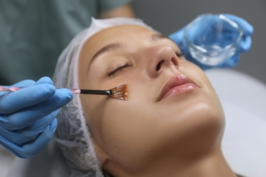 cach tri mun cam hieu qua nhat