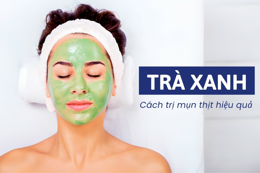 Mụn thịt quanh mắt và cách chữa trị hiệu quả với trà xanh Mụn thịt quanh mắt và cách chữa trị hiệu quả với trà xanh