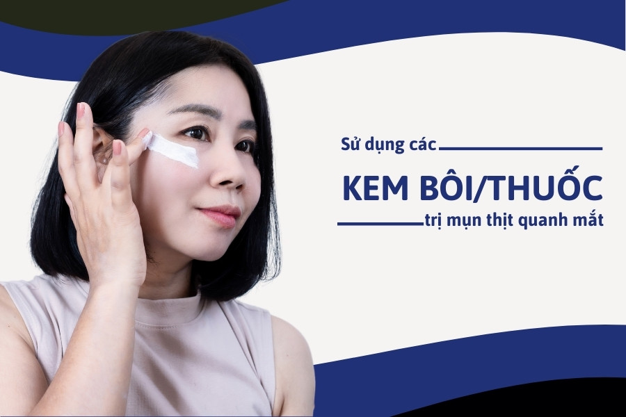 Sử dụng kem bôi hoặc thuốc đặc trị mụn thịt ở mắt Sử dụng kem bôi hoặc thuốc đặc trị mụn thịt ở mắt
