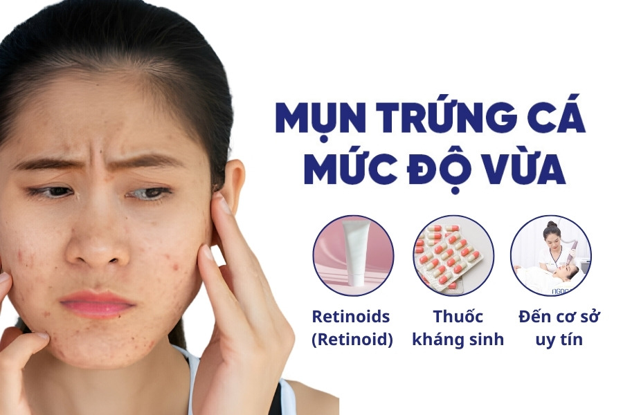 Cách trị mụn trứng các ở mức độ vừa Cách trị mụn trứng các ở mức độ vừa