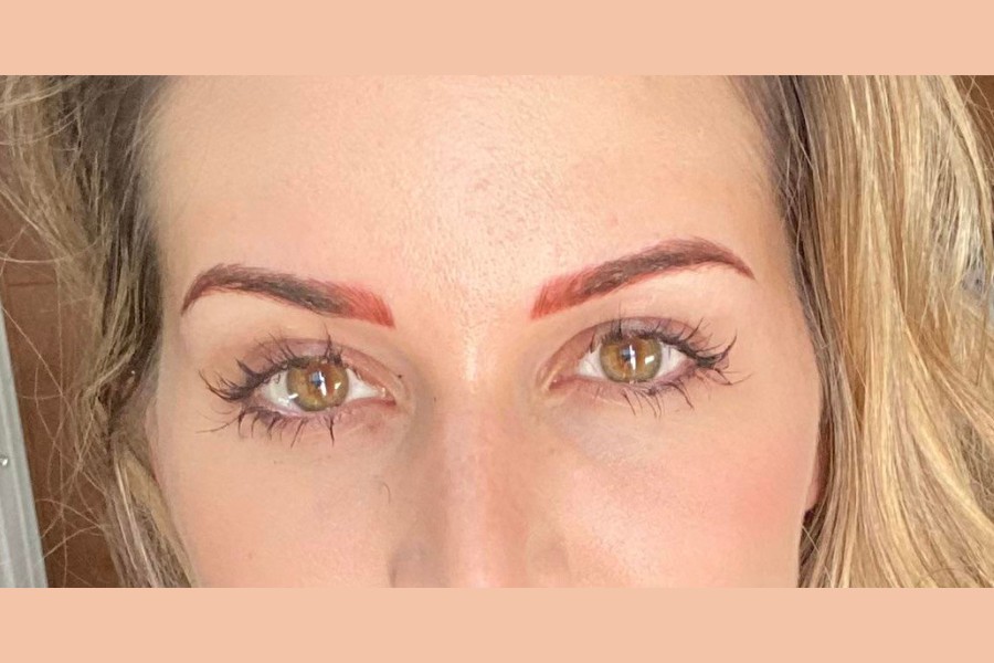 Chân mày bị trổ đỏ khiến cho tổng thể gương mặt thiếu tự nhiên và kém sắc chân mày bị trổ đỏ