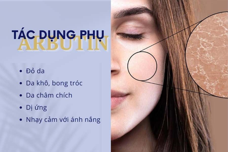 Nếu gặp các tác dụng phụ không mong muốn nên ngừng sử dụng Arbutin và tham khảo ý kiến bác sĩ da liễu