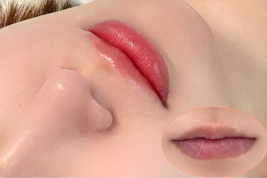 Công nghệ phun môi hiện đại khắc phục các khuyết điểm trên môi như môi thâm, môi lệch