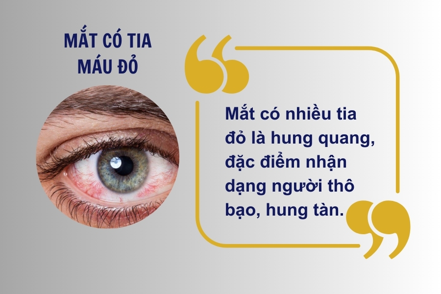 Người có tia máu đỏ trong mắt thường có tính cách thô bạo, hung tàn