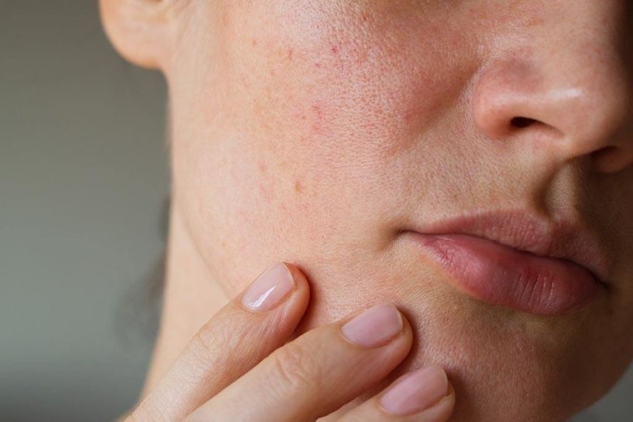 Đắp mặt nạ dưa leo giúp cải thiện tình trạng da sần vỏ cam hiệu quả