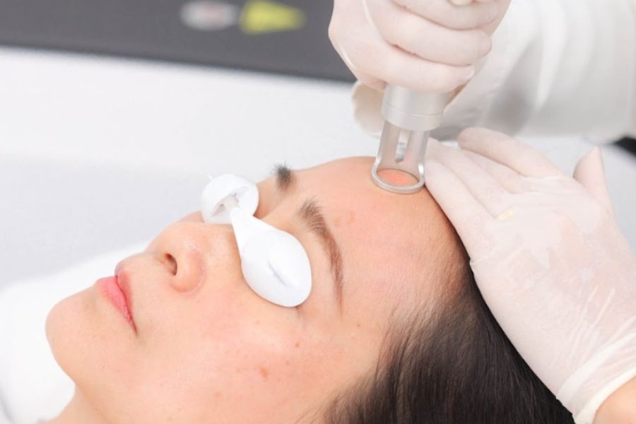 Công nghệ độc quyền White Perfect tại Ngọc Dung Beauty Công nghệ độc quyền White Perfect tại Ngọc Dung Beauty