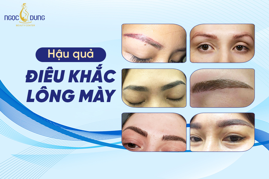 Hậu quả điêu khắc lông mày giá rẻ, tại cơ sở kém chất lượng
