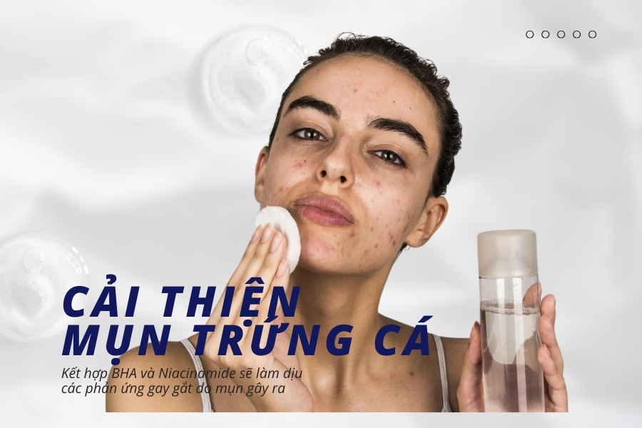 BHA kết hợp với Niacinamide để giúp da tăng cường độ ẩm, đẩy nhanh quá trình phục hồi và giúp giảm thâm mụn BHA kết hợp với Niacinamide để giúp da tăng cường độ ẩm, đẩy nhanh quá trình phục hồi và giúp giảm thâm mụn