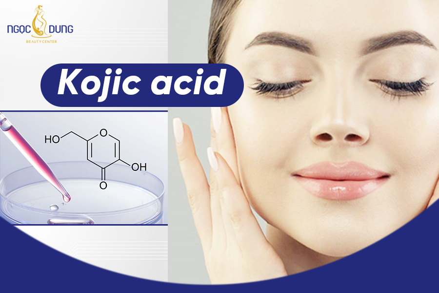 Kojic acid là gì ? Kojic acid và Hydroquinone cái nào tốt hơn?