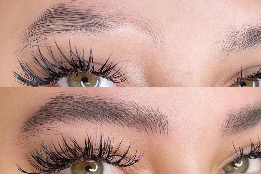 Lông mày ngắn là do di truyền từ bố mẹ hoặc do bệnh lý gây nên