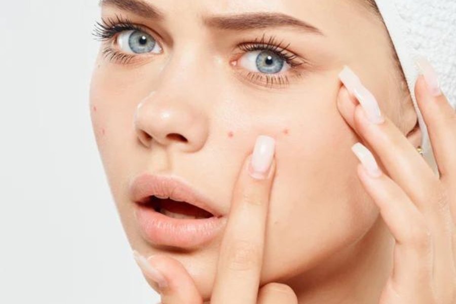 Mặt nạ từ chuối trị mụn, giúp da láng mịn, mờ thâm Mặt nạ từ chuối trị mụn, giúp da láng mịn, mờ thâm