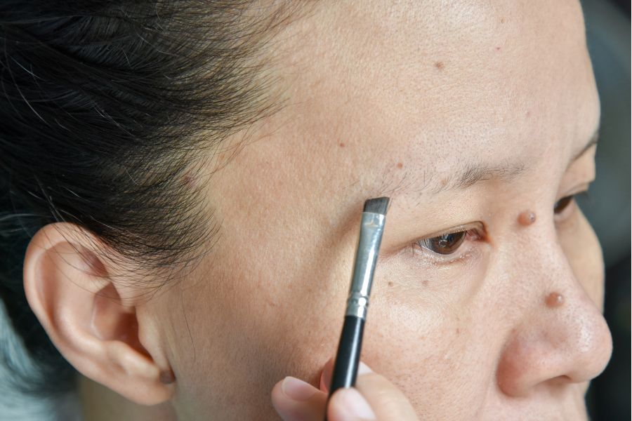 Người không có lông mày da bị viêm da tiết bã Người không có lông mày da bị viêm da tiết bã