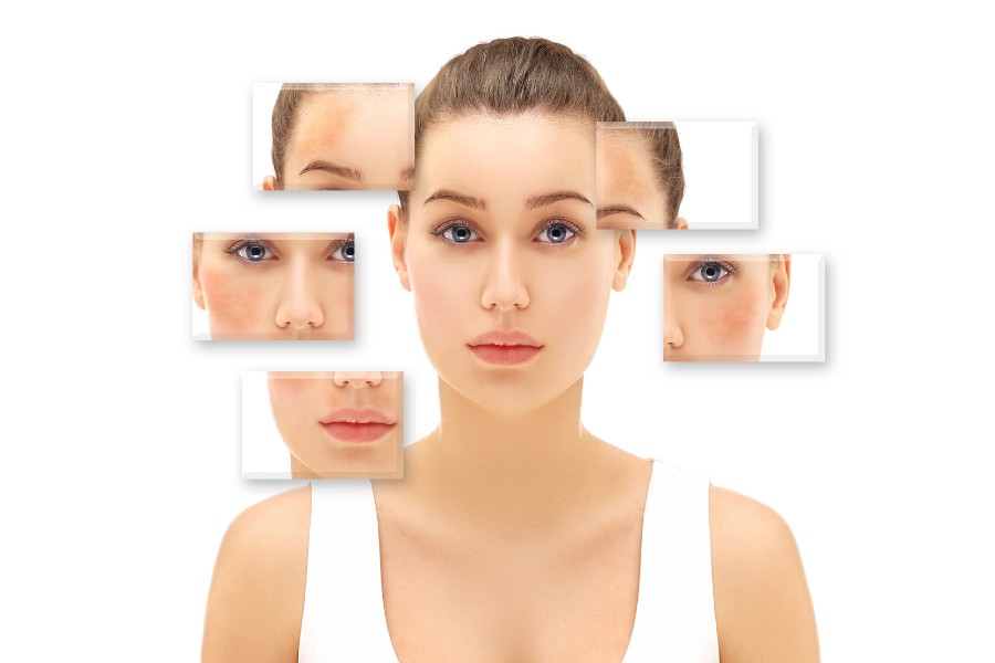 Nhiều chị thường sử dụng nha đam để điều trị các vết thâm nám Nhiều chị thường sử dụng nha đam để điều trị các vết thâm nám