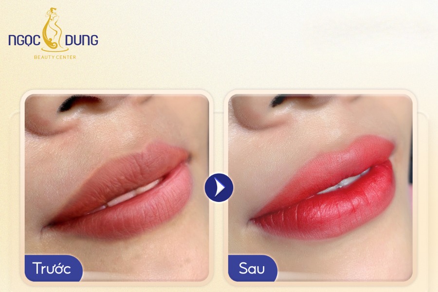 phun môi bao lâu thì uống trà sữa được