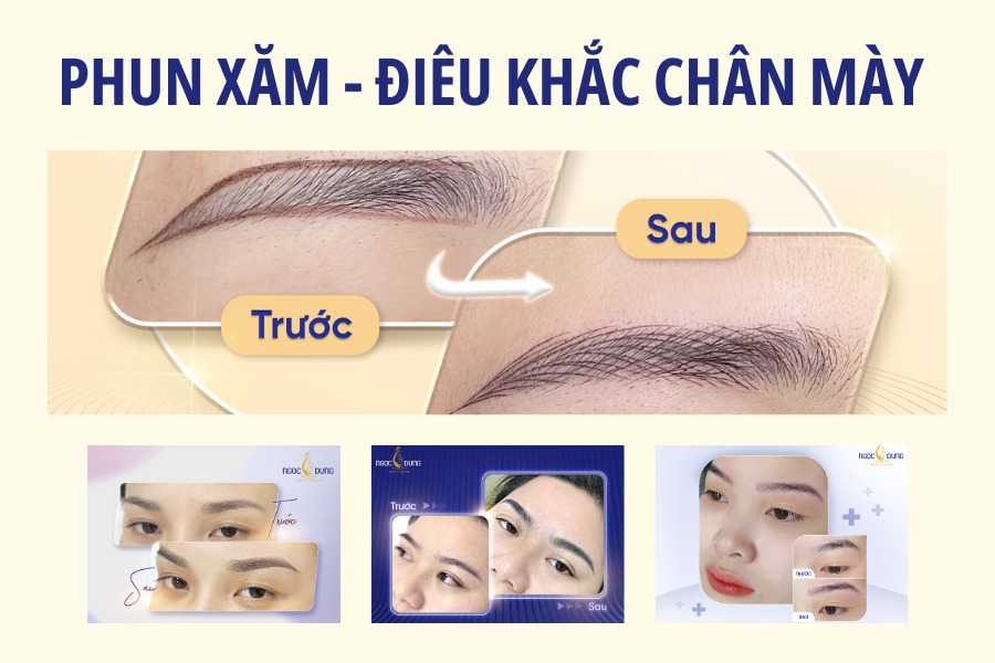Phun thêu thẩm mỹ để cải thiện dáng lông mày mọc ngược