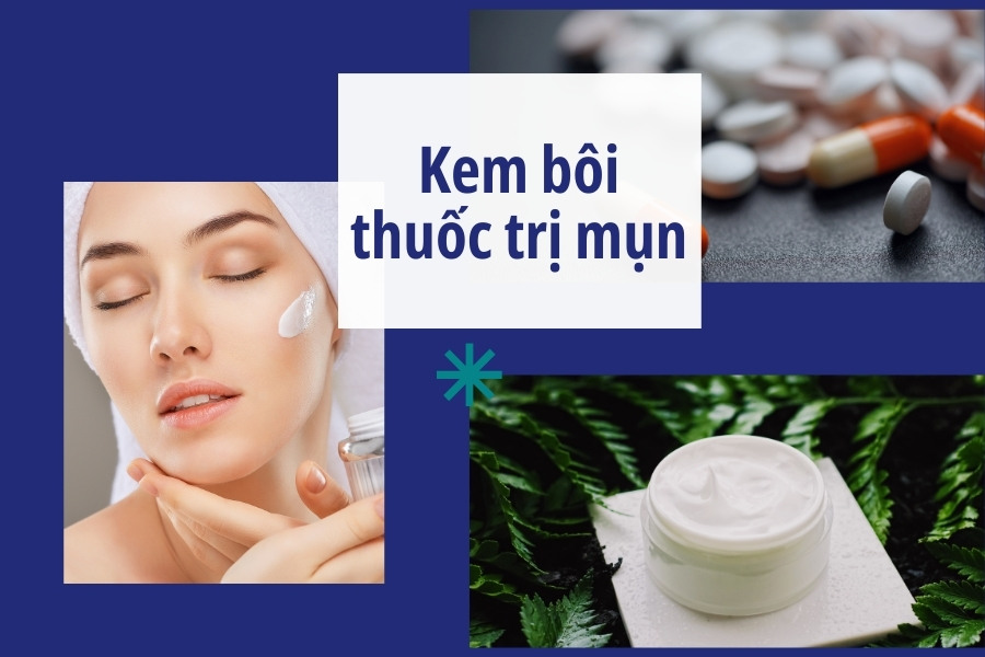 Trị mụn 2 bên thái dương bằng thuốc bôi, thuốc uống hoặc kết hợp cả hai