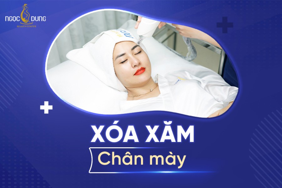 Có nhiều trường hợp cần can thiệp xóa xăm chân mày để khôi phục dáng mày tự nhiên
