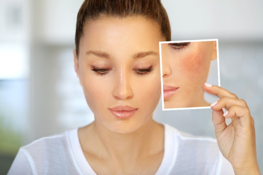 mặt nạ Vitamin E hỗ trợ cải thiện tình trạng tăng sắc tố mặt nạ Vitamin E hỗ trợ cải thiện tình trạng tăng sắc tố