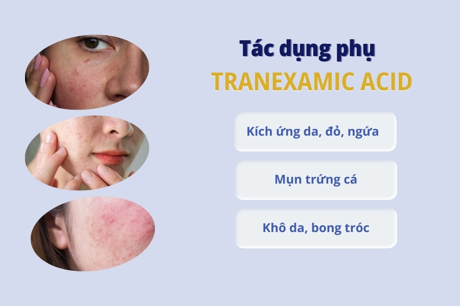 Tác dụng phụ của tranexamic acid là gì?