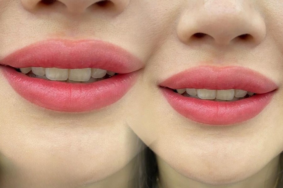 tân trang đôi môi đầy đặn, căng mọng, đều màu với dịch vụ phun xăm môi thẩm mỹ