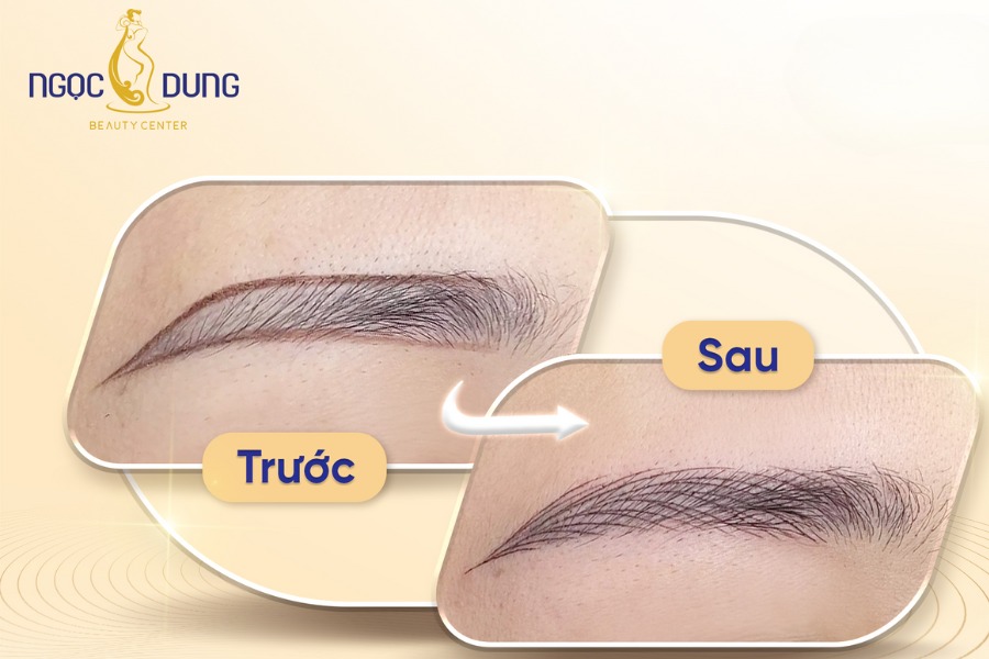 Hình ảnh trước và sau khi hẩm mỹ chân mày tại Ngọc Dung Hình ảnh trước và sau khi hẩm mỹ chân mày tại Ngọc Dung