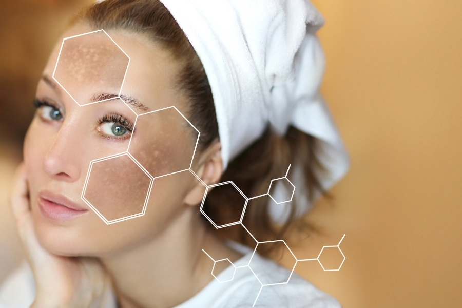 Công dụng của acid tranexamic là gì? Có mạnh hơn hydroquinone không?