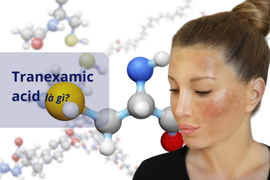 Axit tranexamic là gì? - TXA là chất trị nám, làm trắng da tương tự hydroquinone