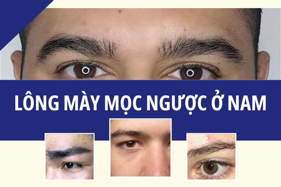 Tướng lông mày dựng ngược ở đàn ông cho thấy họ có tính khí thất thường, thường không gặp may mắn trong tình duyên